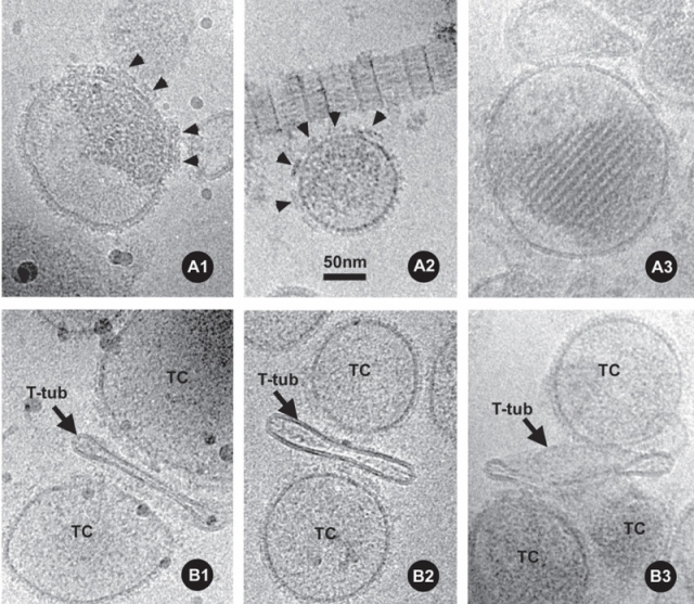 Selected examples of frozen-hydrated isolated TC vesicles and triads