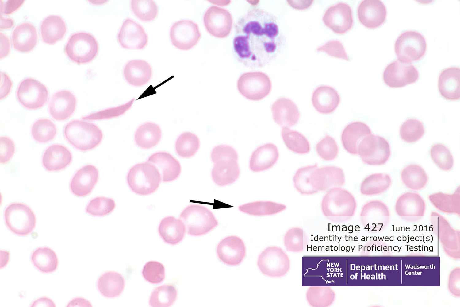 hematology image 427