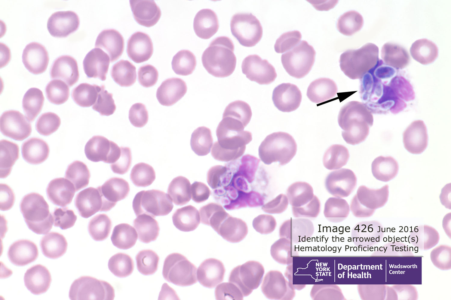 hematology image 426