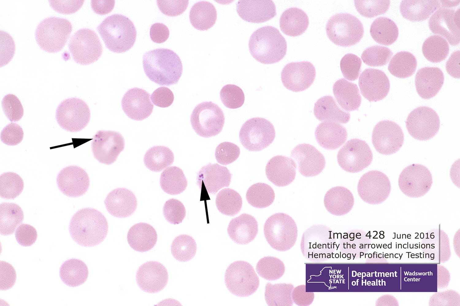 hematology image 428
