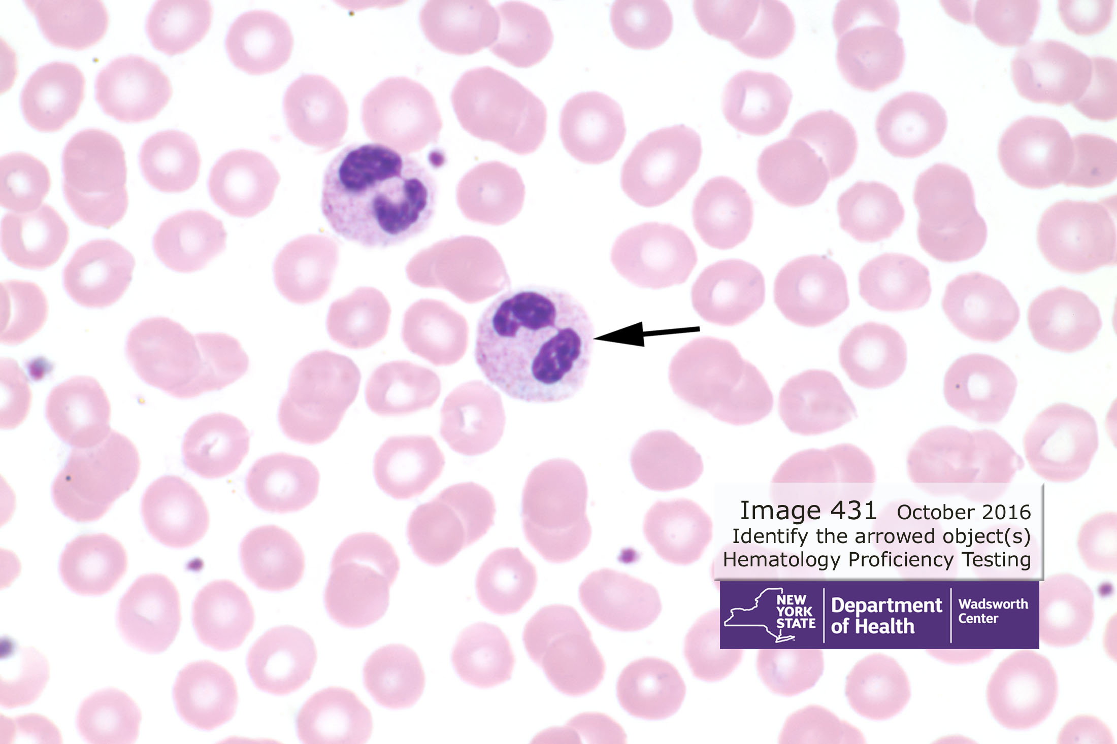 Hematology Image 431