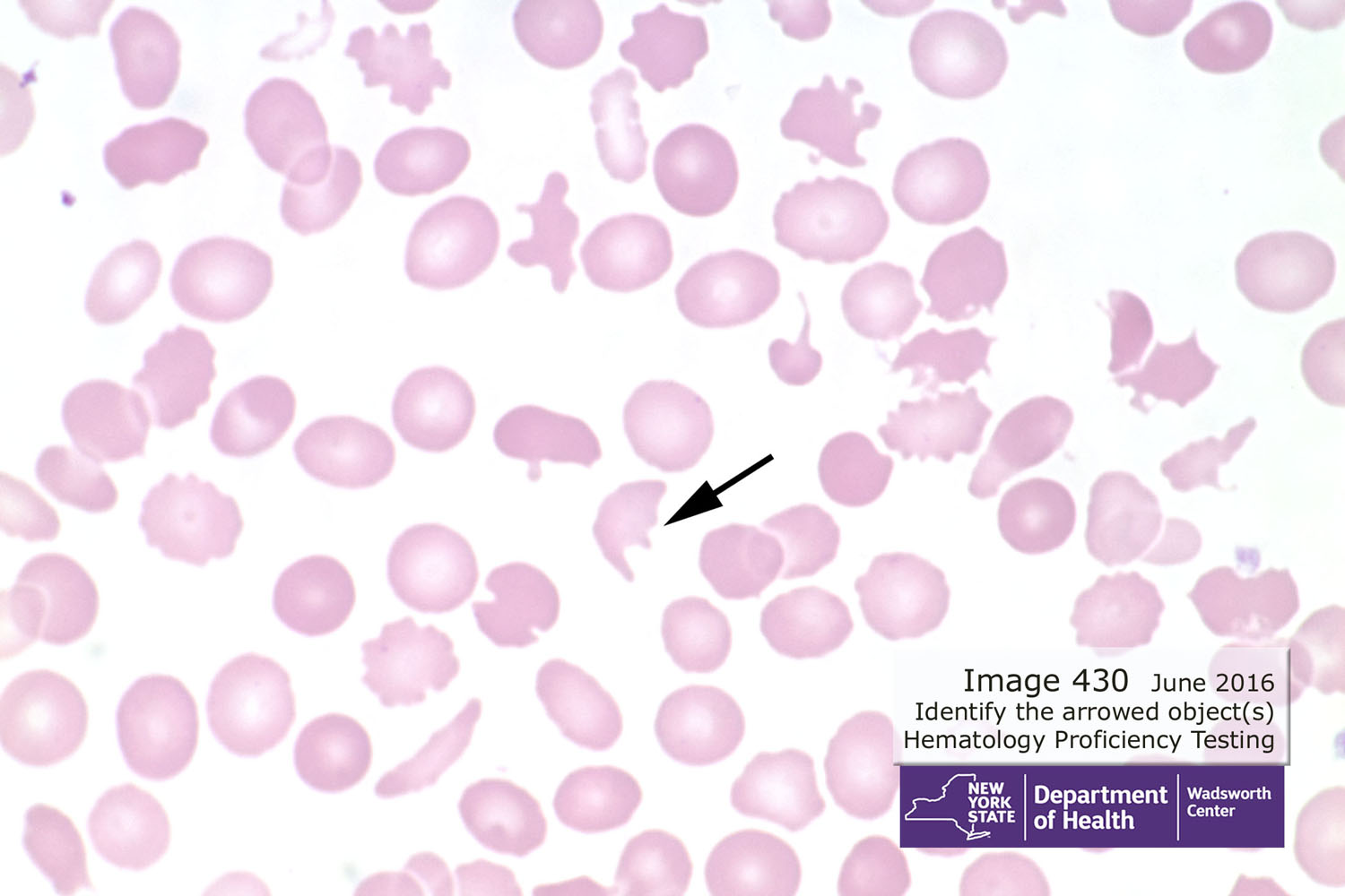 hematology image 430