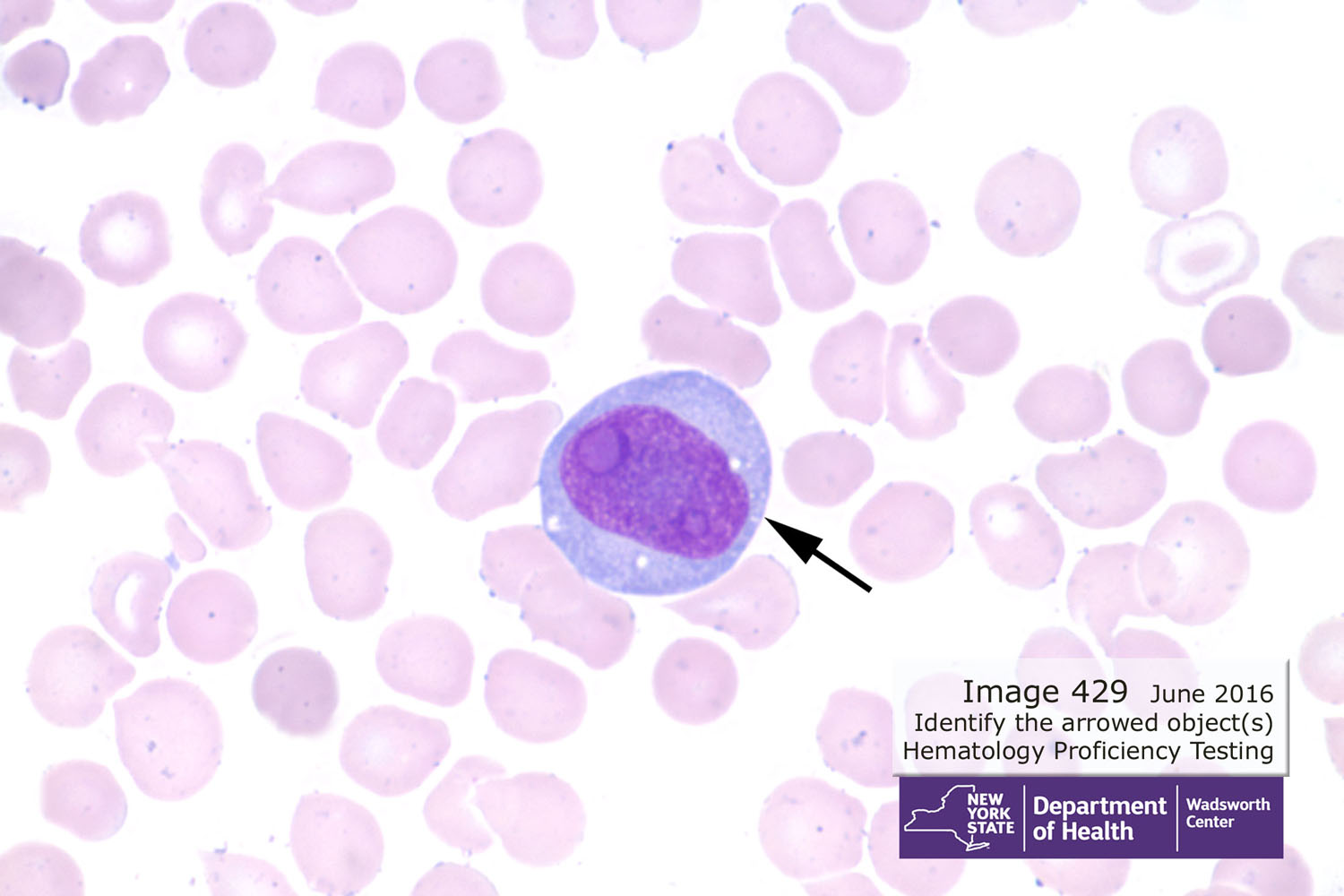 hematology image 429