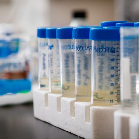 Tubes containing urine specimens Tubes containing urine specimens