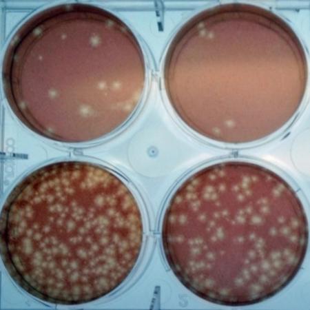 Plaque reduction neutralization test Plaque reduction neutralization test