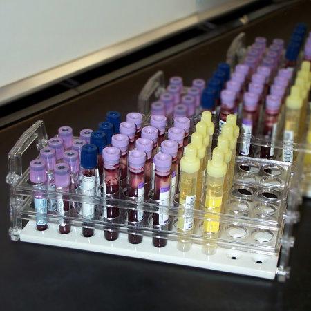 Biomonitoring - tubes containing blood and urine Biomonitoring - tubes containing blood and urine