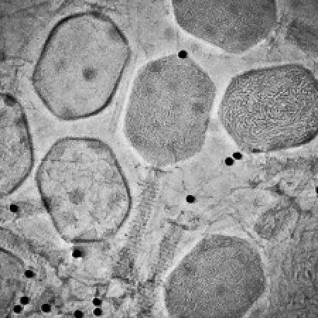 Cryo-TEM image of T4 bacteriophage, vitreously frozen and imaged with phase plate Cryo-TEM image of T4 bacteriophage, vitreously frozen and imaged with phase plate