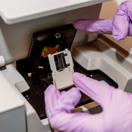 A new screening test for cystic fibrosis will use next generation sequencing. A new screening test for cystic fibrosis will use next generation sequencing.