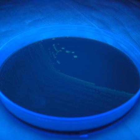 Laboratory Developed Tests Search Tool Laboratory Developed Tests Search Tool