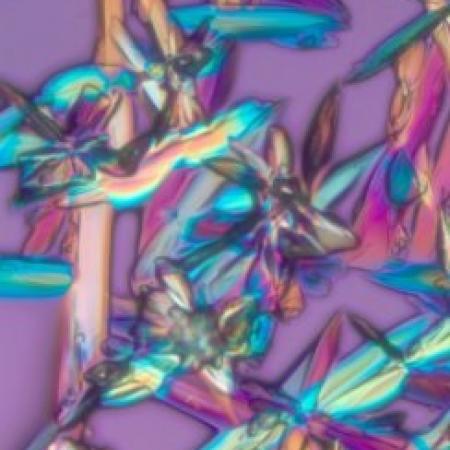 Polarized light image of glucose. Richard Cole, Wadsworth Center Polarized light image of glucose. Richard Cole, Wadsworth Center