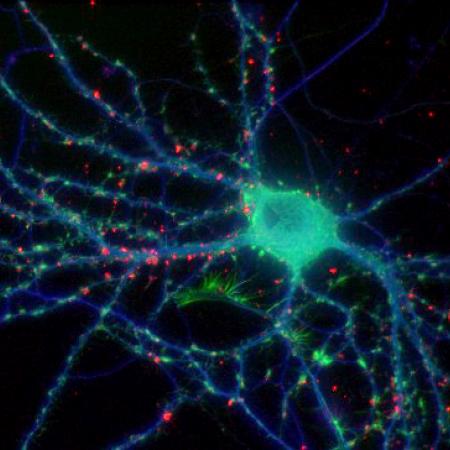Fixed neuron. Tubulin shown in blue, F-actin in green, presynaptic protein in red. Specimen courtesy of Natalie Dowell-Mesfin Fixed neuron. Tubulin shown in blue, F-actin in green, presynaptic protein in red. Specimen courtesy of Natalie Dowell-Mesfin