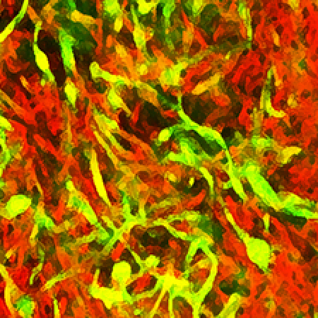 Biofilms of Mycobacterium smegmatis cells - Ojha Laboratory Biofilms of Mycobacterium smegmatis cells - Ojha Laboratory
