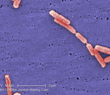 Colorized SEM Legionella. Photo credit: Janice Haney Carr; Content: CDC/Margaret Williams, Claressa Lucas, Tatiana Travis Colorized SEM Legionella. Photo credit: Janice Haney Carr; Content: CDC/Margaret Williams, Claressa Lucas, Tatiana Travis