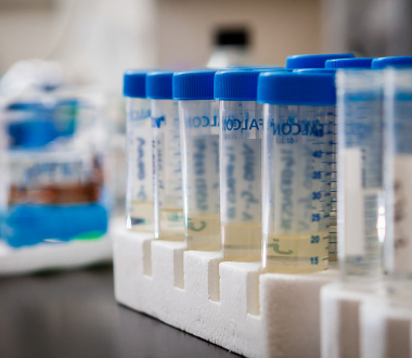 Tubes containing urine specimens Tubes containing urine specimens