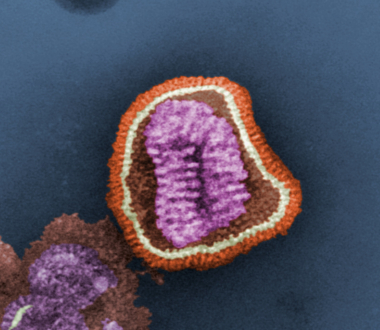 Influenza virus. Photo credit Frederick Murphy. Content provider CDC/Erskine Palmer, PhD; ML Martin