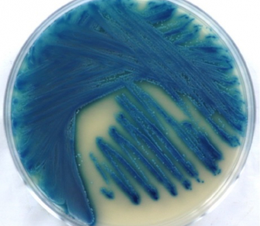 Candida blankii Candida blankii