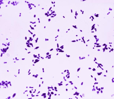 Streptococcus pneumoniae Photo credit: CDC / Arnold Kaufman