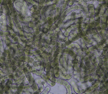 Micrograph of Aetokthonos hydrillicola culture. Photo credit: Chris Tucker.