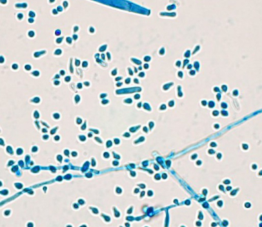 Trichophyton indotineae with macro and micro conidia 