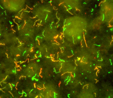 Lyme Disease Bacteria, Borrelia burgdorferi Credit: NIAID, NIH Lyme Disease Bacteria, Borrelia burgdorferi Credit: NIAID, NIH