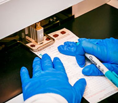 Newborn Screening Newborn Screening