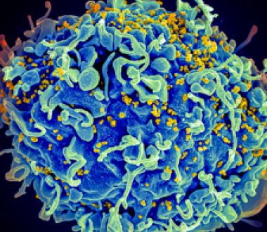 HIV (yellow) attacking T cell. Credit: Seth Pincus, Elizabeth Fischer, Austin Athman, NIAID, NIH