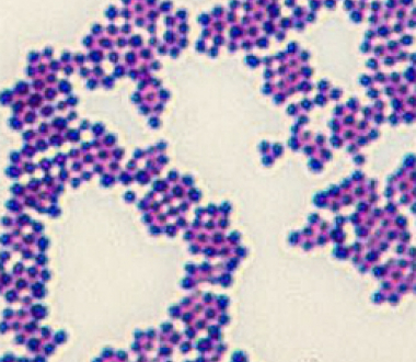 Gram stain of Staphylococcus aureus, a Gram-positive bacterium that is capable of causing human infections.