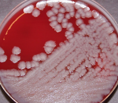 B. anthracis Sterne strain B. anthracis Sterne strain
