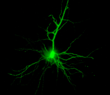 A neonatal rat pyramidal neuron filled with Lucifer Yellow