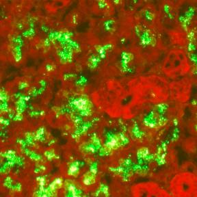 Micrograph in red and green with green showing rabies virus