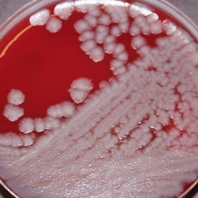 B. anthracis Sterne strain
