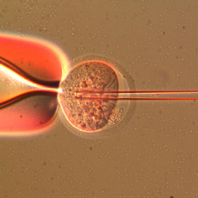 mouse ICSI (Intra-cytoplasmic sperm injection)