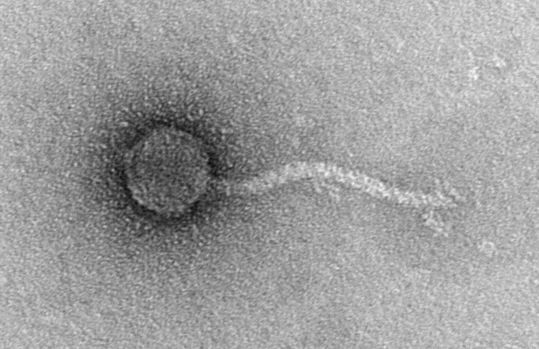 Caption: A transmission electron micrograph of phage FtMidnight, which is dependent on the F plasmid of E. coli. Caption: A transmission electron micrograph of phage FtMidnight, which is dependent on the F plasmid of E. coli.