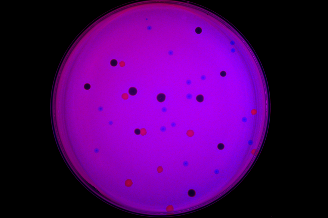 caption: A phage DisCo plate showing plasmid dependent phages (black plaques), Salmonella phages (blue plaques) and Pseudomonas phages (red plaques). caption: A phage DisCo plate showing plasmid dependent phages (black plaques), Salmonella phages (blue plaques) and Pseudomonas phages (red plaques).