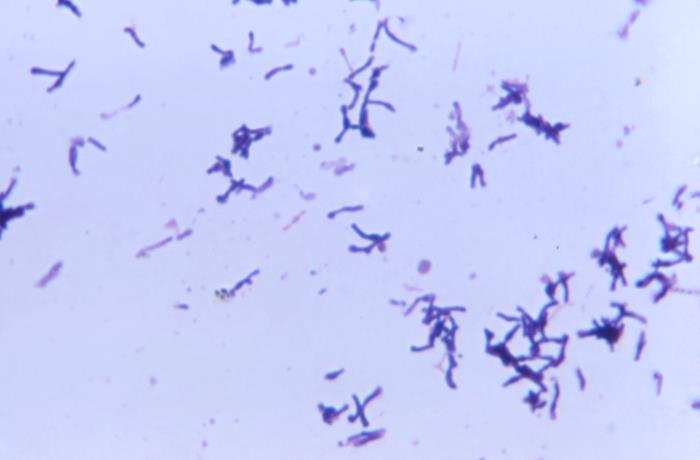 Propionibacterium acnes