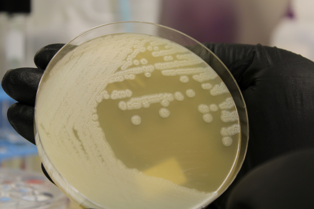 Clostridium botulinum