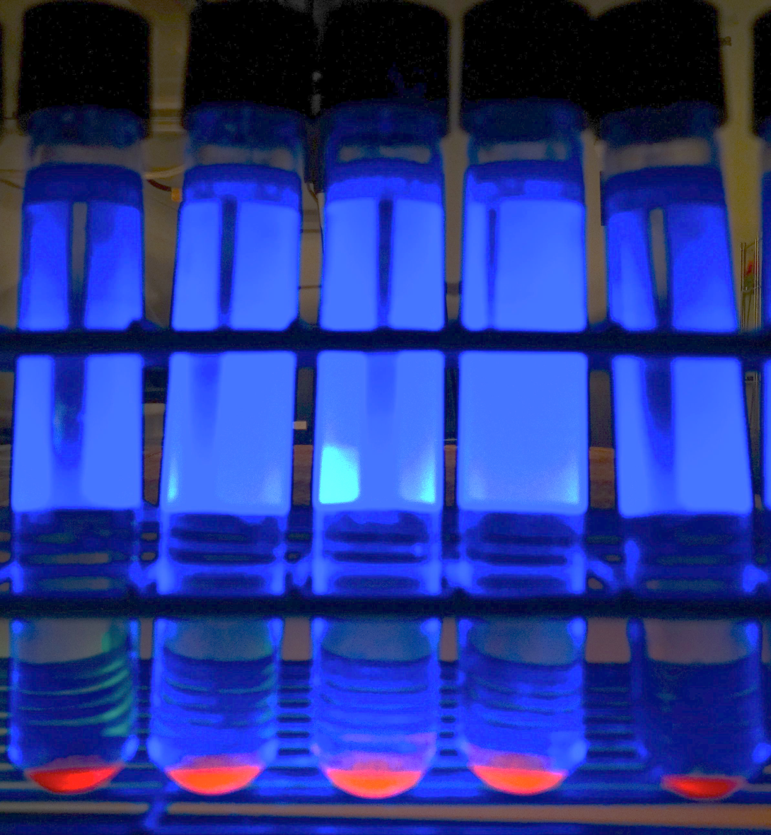 Cultures sent for mycobacterium testing are inoculated into MGIT ™ tubes. Growth is detected using fluorescence. (Photo by Dennis Biggins)