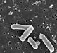 Scanning electron micrographs of Salmonella treated with a neutralizing antibodies Sal4. Control bacteria Scanning electron micrographs of Salmonella treated with a neutralizing antibodies Sal4. Control bacteria